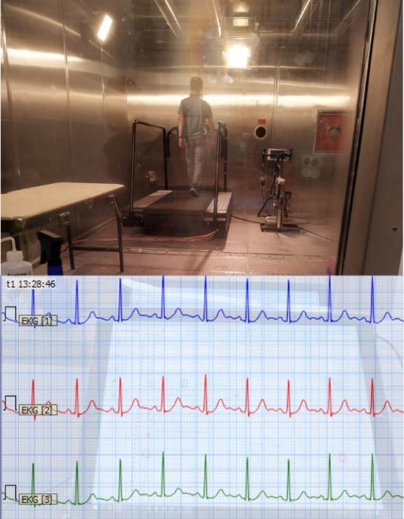 Nahtlos ECG Textile Carrier tests